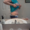 post op 3days