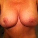 I like that they are "perky" but they are still too big I think!  Maybe when I lose that last 20 lbs they'll shrink!! (and hopefully not sag!  my ps told me it was preferable to lose weight first! lol)