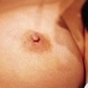 23 Year Old Female Patient 