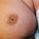 23 Year Old Female Patient 