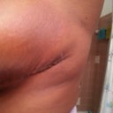 wanted to get a close up of the bruising and rashes around the bruises. So weird