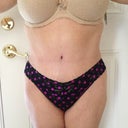18 days post PO .. after a 2 mile work... I did too much walking but I am happy with my new tummy. Still swollen under the belly button area.