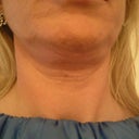 Creepy neck pic taken 29th March