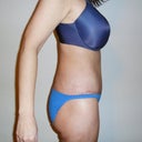 One month side view