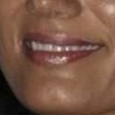 My lips have been uneven :( D