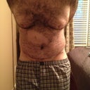 Day 3 post op