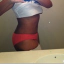 One year from tummy tuck, 6 weeks from