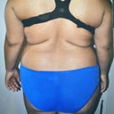 :(   (pre-op)