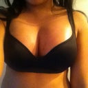 10 days post op.  :)