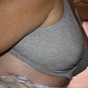 Post-op day 3