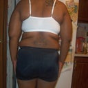 My back - 16 days PO
