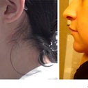 2 months post of profile