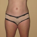 Front 3 months