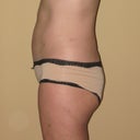 Side 3 months