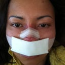 The day after surgery