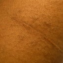 large lipoma removed from forearm