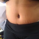 Day 8 post op