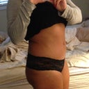 4 months post op