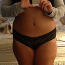 4 months post op