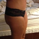 4 months post op