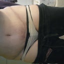 3 Weeks and 5 days post op.  Looking a lot better but still swollen.  Scar is healing nicely.