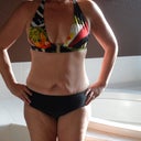 Pre-op swim suit pic