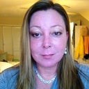 Day 5 wearing make- up. still very swollen at the jawline and eyes.... look 10 lbs heavier in the face.