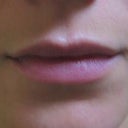 about 1 month after