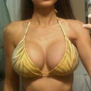 1 month post op, cleavage greatly improved, increase in volume really balanced out my figure, makes my waist look smaller