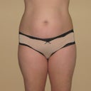 front before