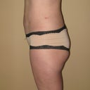Side 3 weeks