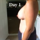 Day 1 side view. I'll be excited when that slope inverts itself a few months down the road. I prefer the natural look.