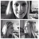 2 weeks post procedure sooo happy!!!