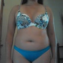 3 days pre op