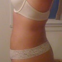 4 weeks post op