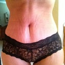 PO Day 22 - PS did a great job getting my scar line low, I have stretch marks still & I just took my binder off.