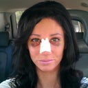 4 days after surgery. Walking in to get the cast off. SEE YA!!!!!! ;)
