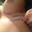 Incision from post-op day 2.