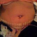 Day three post op. First time I had a peek
