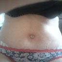 Two weeks post op. Drains removed on day 8. Kind of swollen