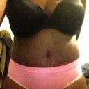 Another pic of flat side still swelling but minimal post op 21 days