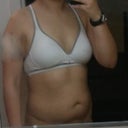 Only before picture I have right now-- waiting on for befores from my Dr