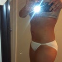 1 week post side view