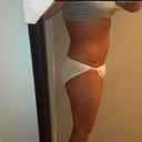 1 week post