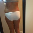 1 week post