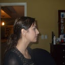 After radiesse no more lopsided dented nose.