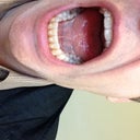 You can see the staining here along with the multitude of attachments.