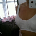 2 Days post op