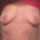 Day after explant