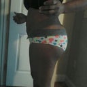 11 days post opt